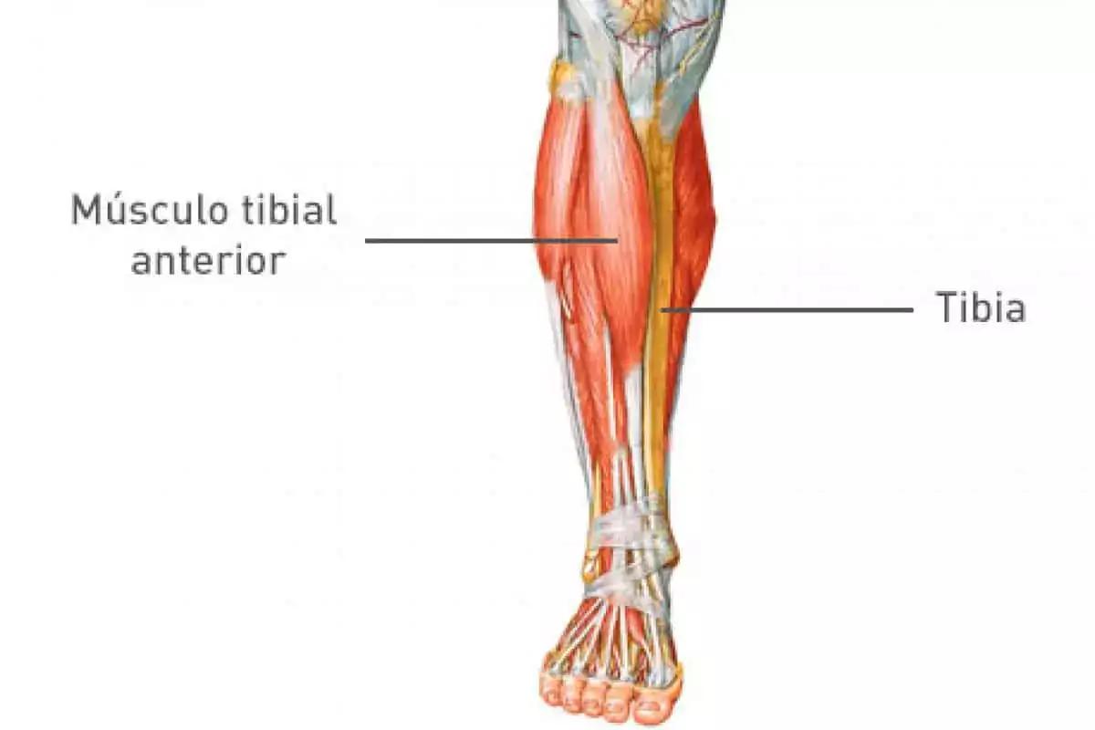 Periostitis tibial