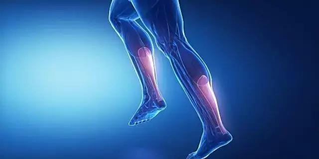 Achilles Tendonitis